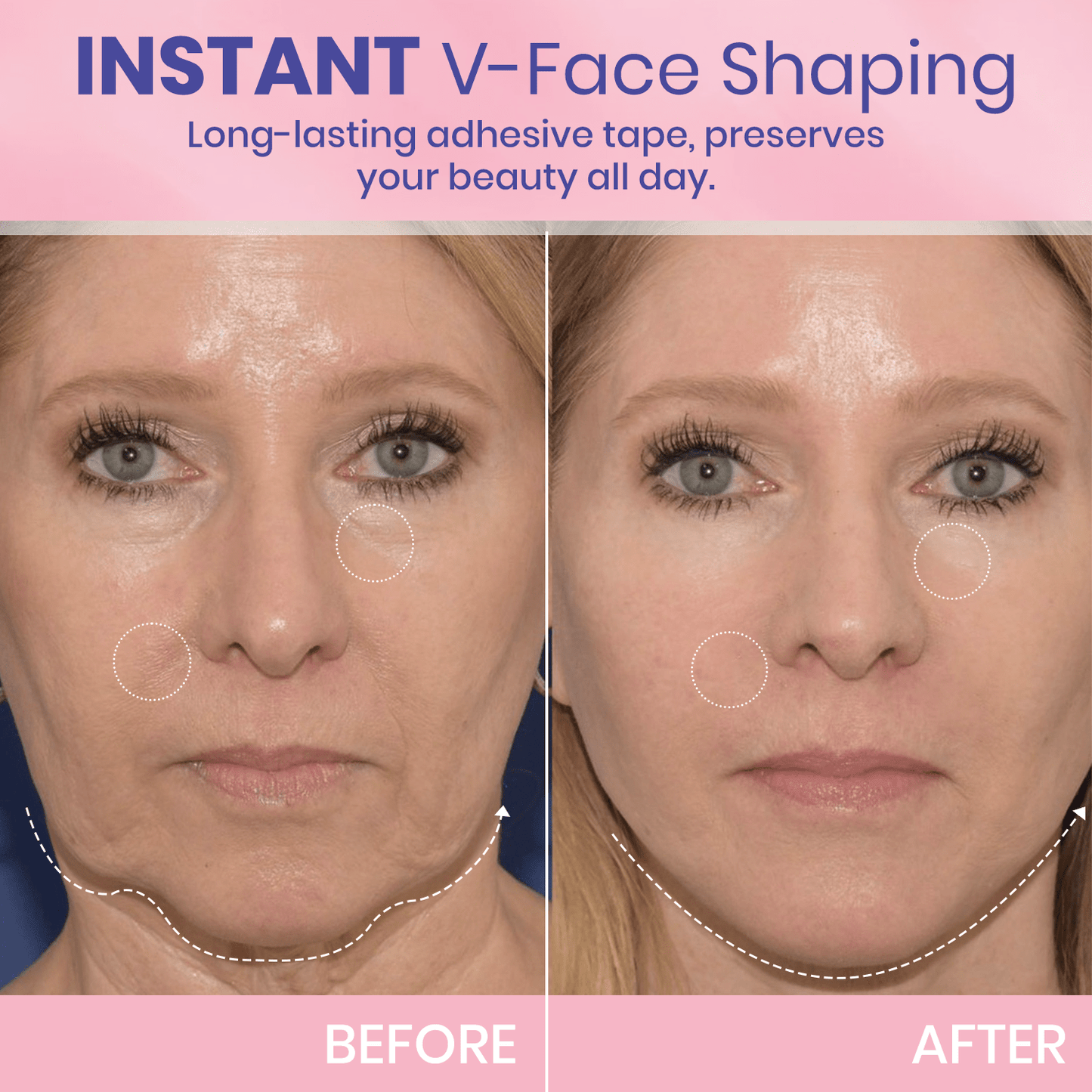 V-Face 👑 Nastro lifting invisibile
